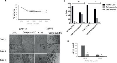 Compound C, a Broad Kinase Inhibitor Alters Metabolic Fingerprinting of Extra Cellular Matrix Detached Cancer Cells